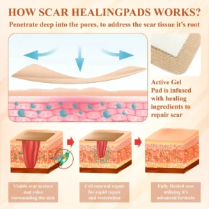 ScarEase™ SiliconeFoam Healing Pads