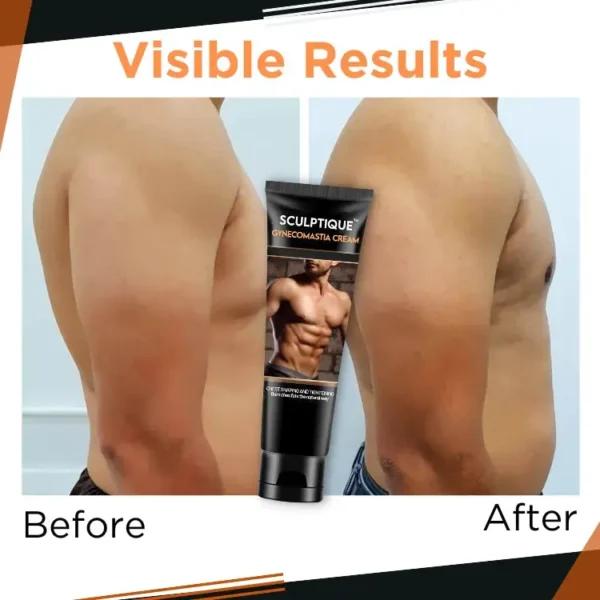 Sculptique™ Gynecomastia Cream