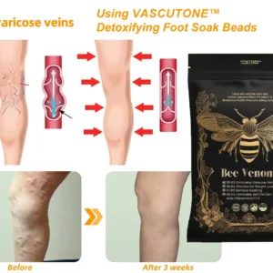 VascuTone™ Bee venom lymphatic detoxification slimming foot bath beads