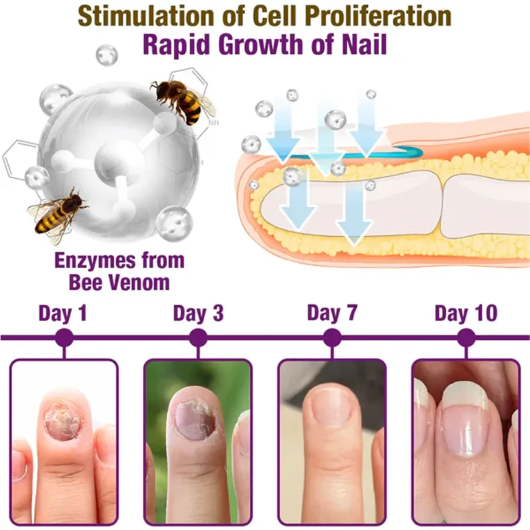 flysmus™ FungiFree Anti-fungal Bee Venom Nail Serum