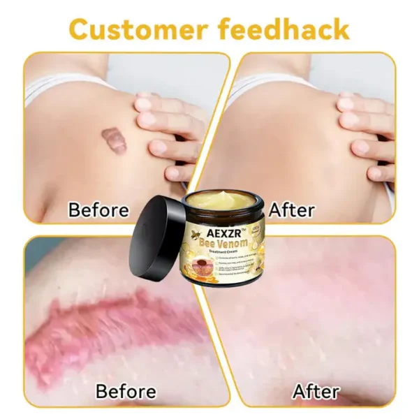 AEXZR™ Bee Venom Skin Treatment Cream - Image 4