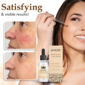 AEXZR™ Rosacea Cure Serum