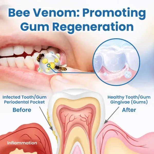 Ceoerty™ RevitaDent Bee Venom Oral Treatment Powder - Image 4