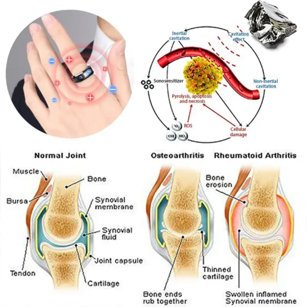 DIYSTAR Lymphatic magnetic therapy ring - Image 4