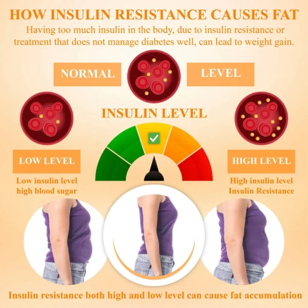 InsuBurn™ LipidFlush BodySlimming Cream