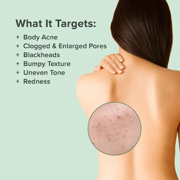 LIMETOW™ Back Acne Treatment Spray - Image 3