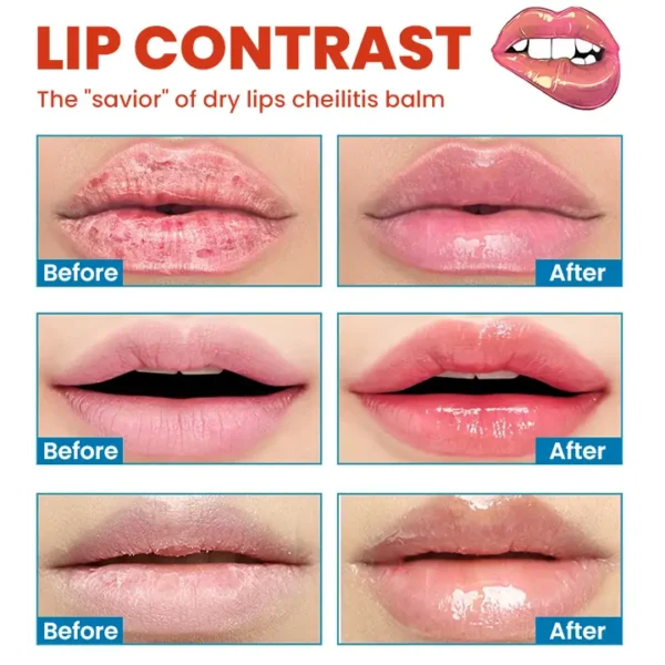 LIMETOW™ Cheilitis Cream - Image 12