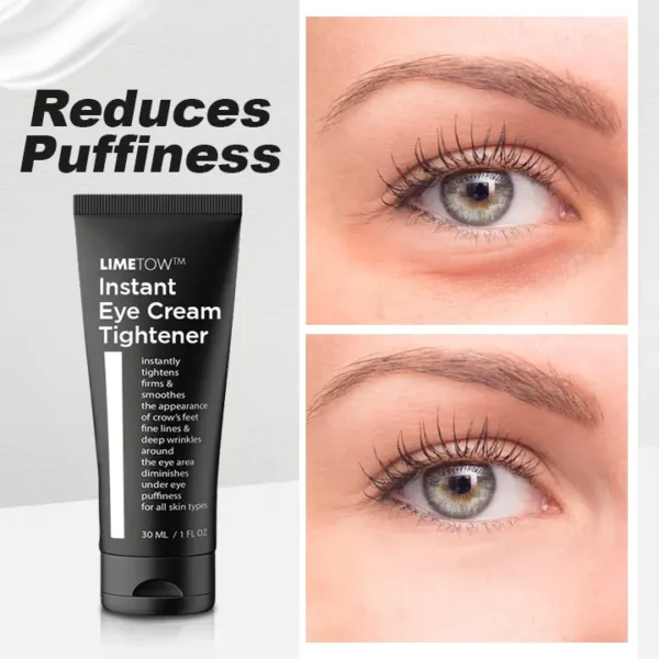 LIMETOW™ Instant Eye Cream Tightener - Image 2