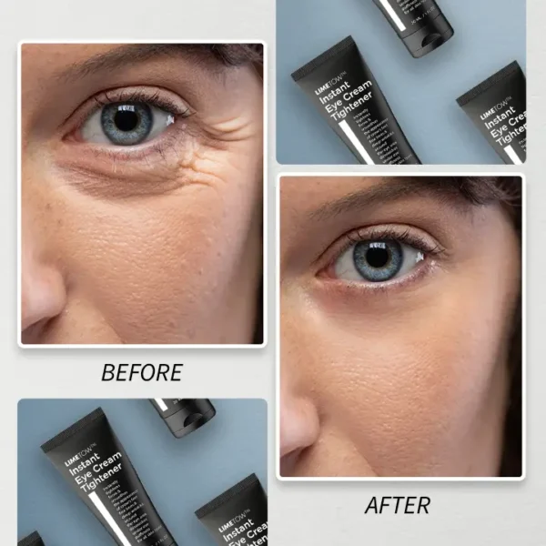 LIMETOW™ Instant Eye Cream Tightener - Image 7