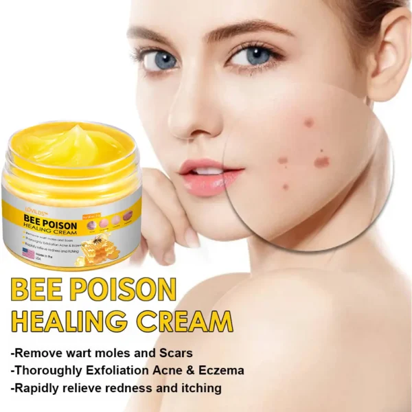 LOVILDS™ Bee Poison Skin Cream - Image 5