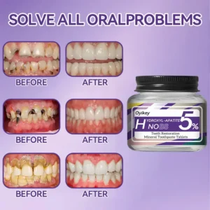 Oyikey™ Teeth Restoration Mineral Toothpaste Tablets