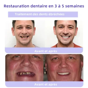 Oyikey™ Teeth Restoration Poudre Minérale