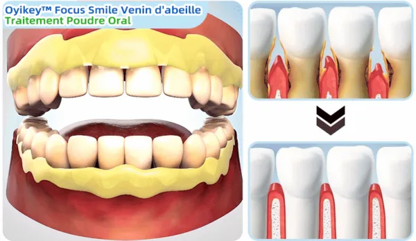 Oyikey™ Teeth Restoration Poudre Minérale