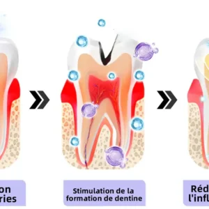 Oyikey™ Teeth Restoration Poudre Minérale