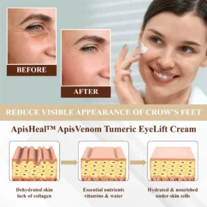 ApisHeal™ ApisVenom Tumeric EyeLift Cream