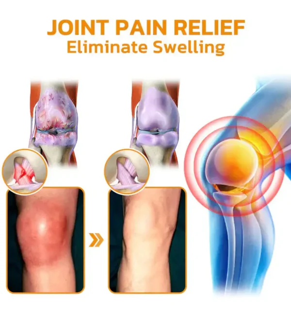 flysmus™ Lidocaine Arthritis Pain Relief Healing Gel - Image 14